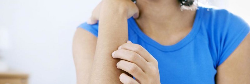 Picture of a young woman scratching her itchy arm with allergy rash.