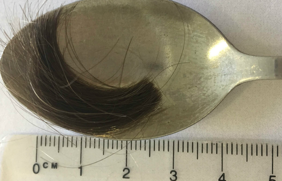 Sample of hair strands in a spoon for testing